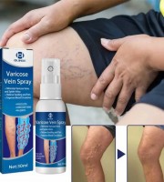 Varicose Vein Treatment Spray
